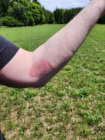 Tribut.JPG (1.35 MiB) 3241 mal betrachtet Dieses Jahr nur Tribut, aber kein Blutzoll, als es einen Pfeil zerrissen hat (man sieht schön die Narbe vom letzten Jahr)